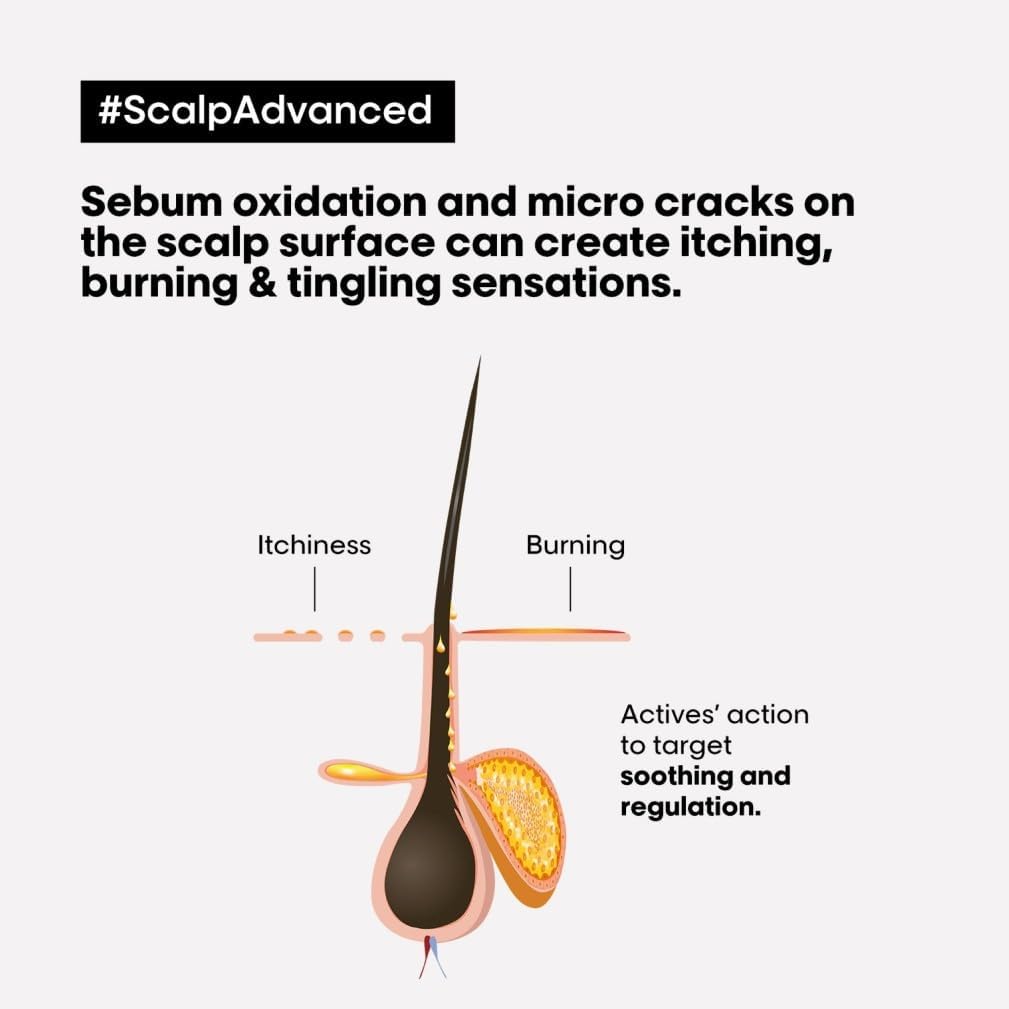 L’Oréal Professionnel Serie Expert Scalp Advanced Anti-Discomfort Treatment 200ml