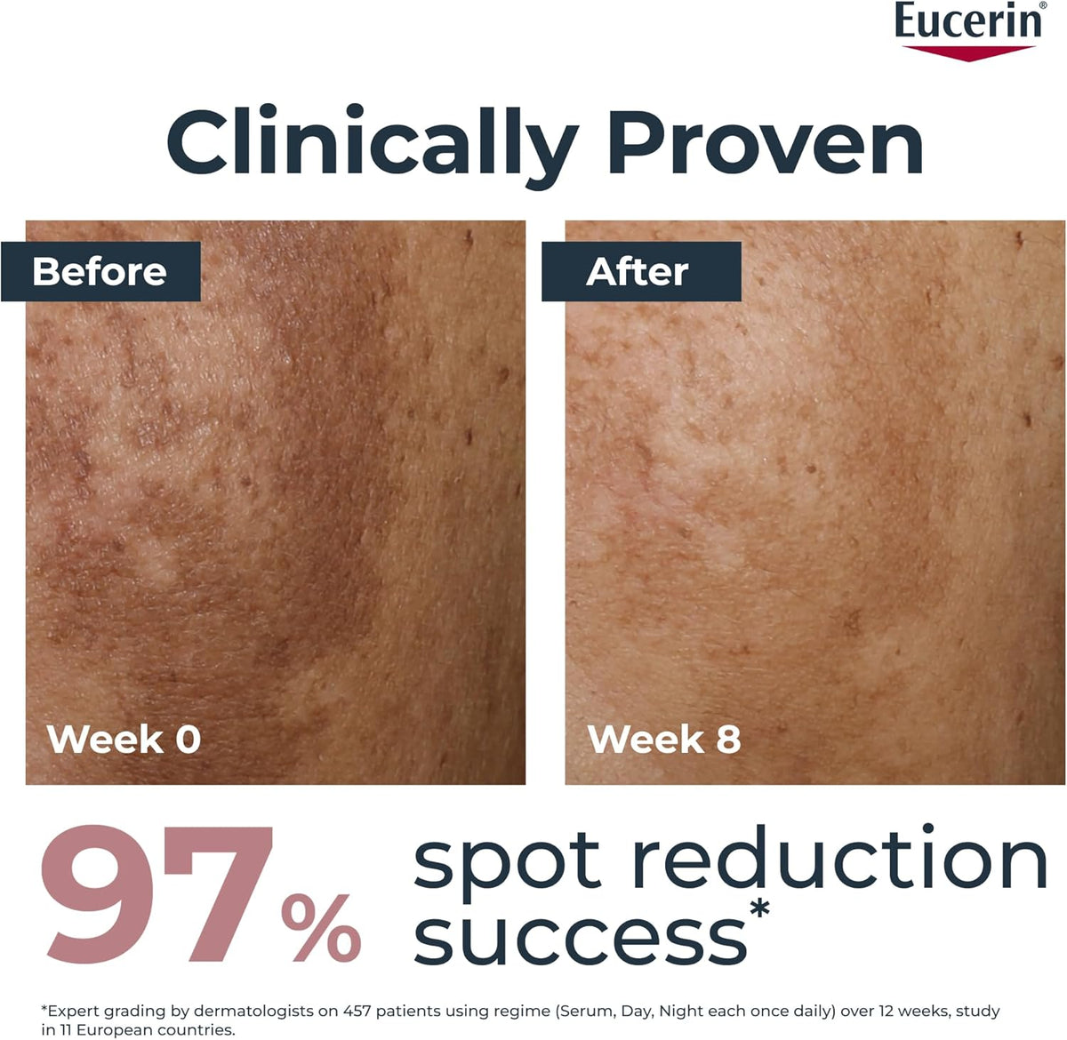 Eucerin Anti-Pigment Night Cream 50ml, Enriched Face Cream to Reduce Appearance of Age Spots Hyperpigmentation Treatment Formula with Thiamidol to Reduce Dark Spots